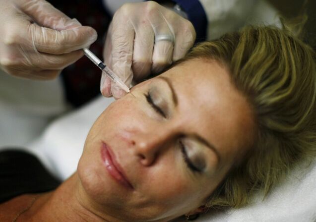 Töltőanyagok bevezetése az arc bőrébe - injekciós módszer a szigorításhoz