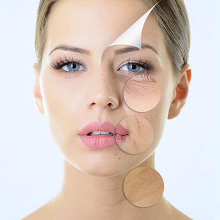 Az arcbőr tökéletlenségei - jelzések az öregedésgátló eljárásokhoz